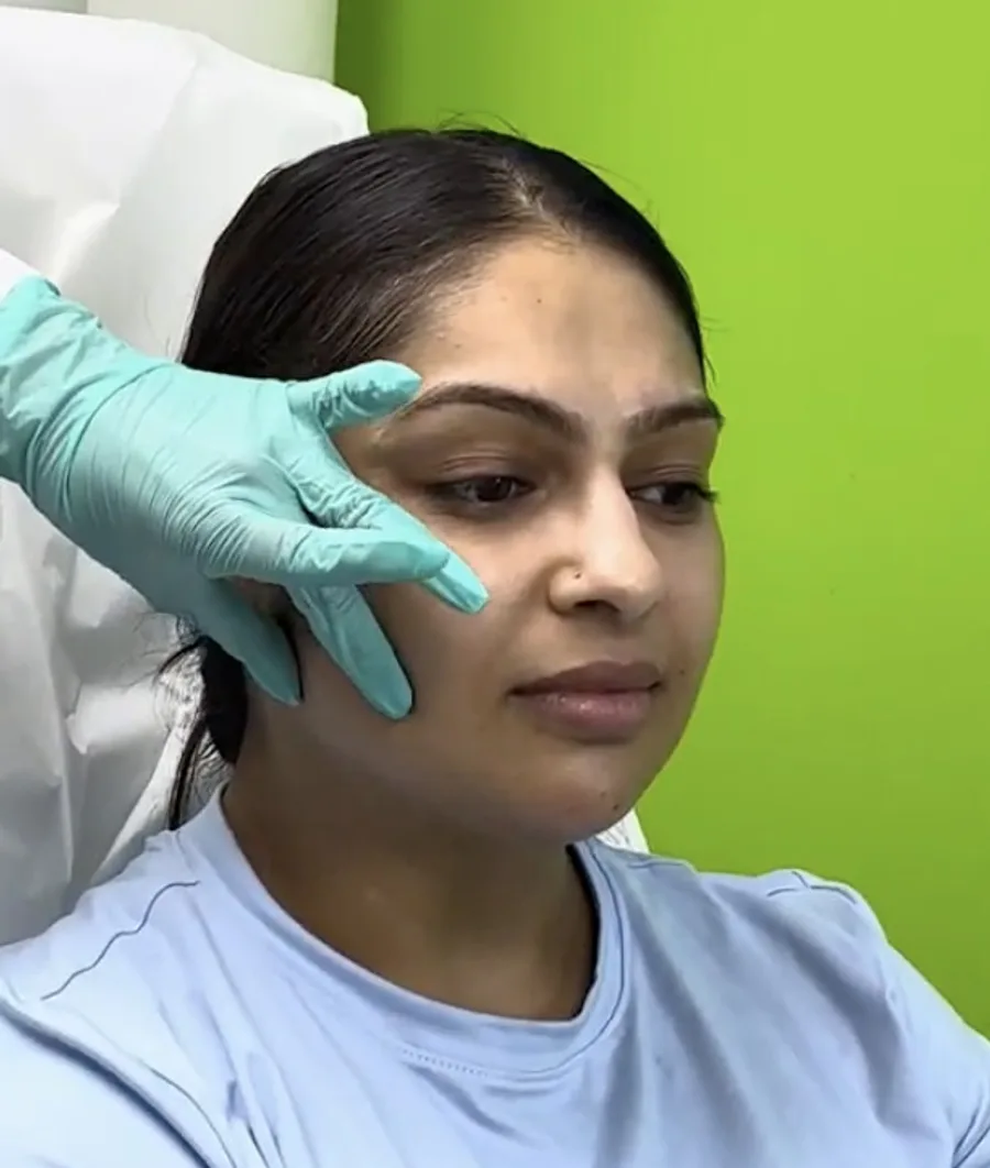 Dermal filler injectable treatment in Naperville, IL