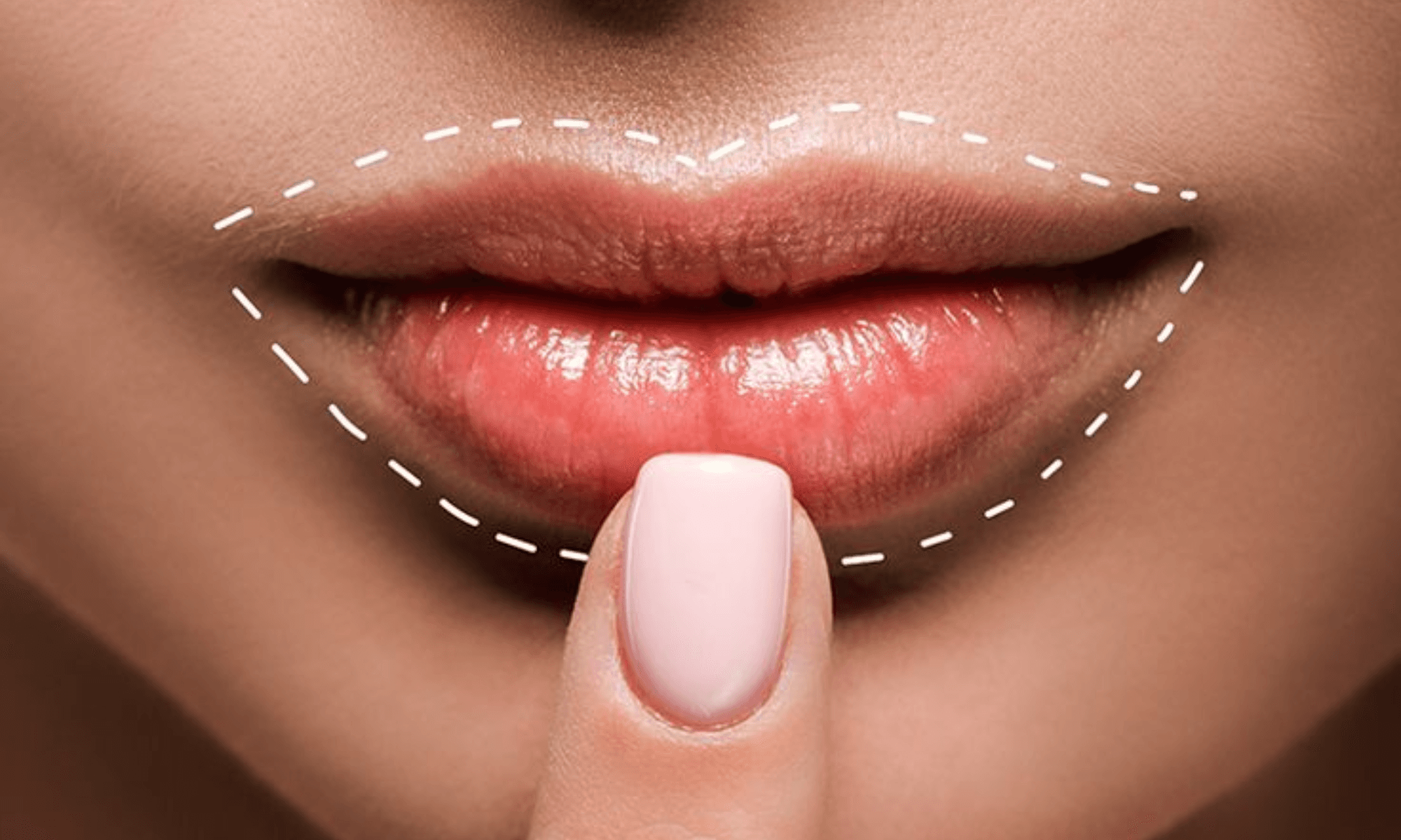 Lip Plumping Treatment