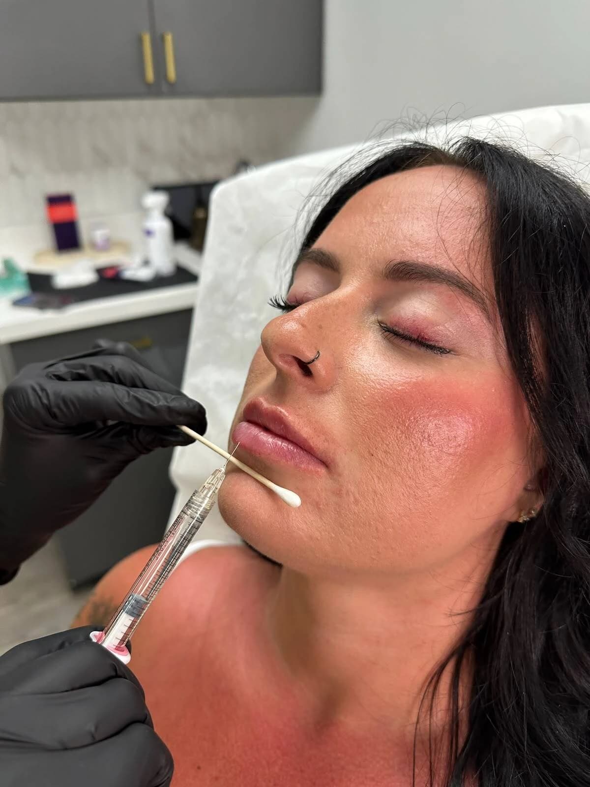 Botox injection treatment at our Naperville clinic