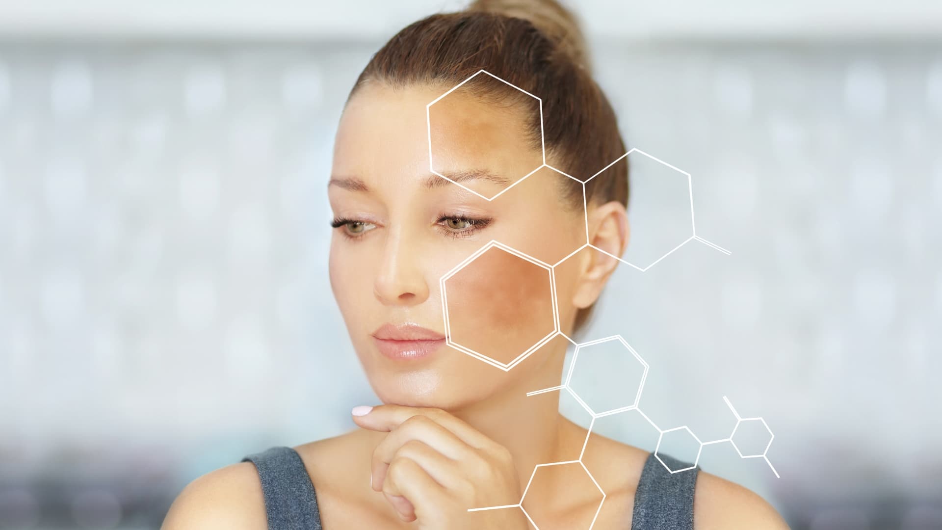 Hyperpigmentation & Dark Spots service at Naperville Health & Wellness Clinic