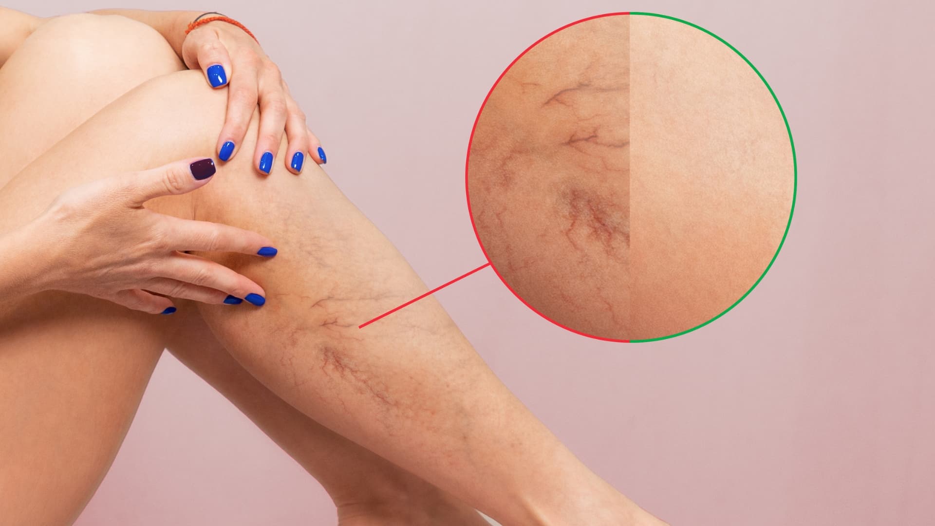 Vascular & Skin Correction service at Naperville Health & Wellness Clinic