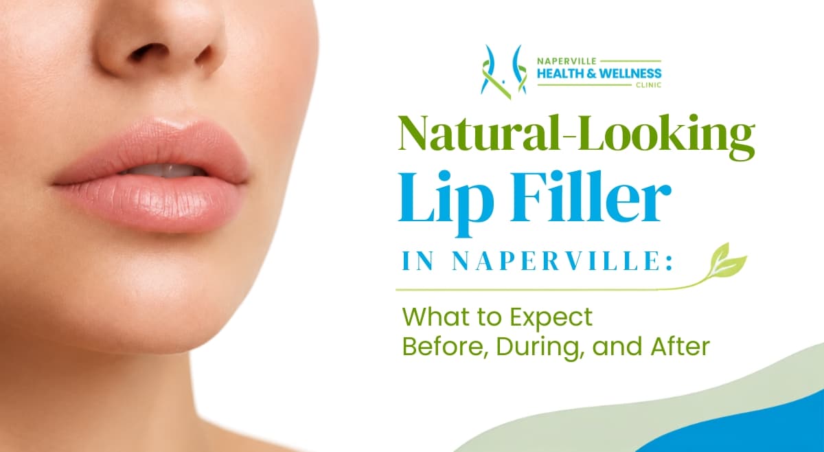 Natural-looking lip filler in Naperville close-up of a woman's lips at Naperville Health & Wellness Clinic
